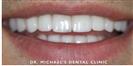 Couture Smile - Dr. Michael’s Dental Clinics
